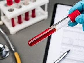 Uma pessoa usando luva azul segurando um tubo de exame de sangue Uma pessoa usando luva azul segurando um tubo de exame de sangue