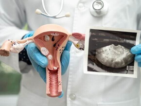 modelo anatômico do útero sendo exibido por um médico com luvas e ultrassonografia ao fundo.