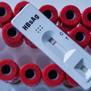teste rápido de HBsAg em destaque entre tubos de coleta de sangue no laboratório. teste rápido de HBsAg em destaque entre tubos de coleta de sangue no laboratório.