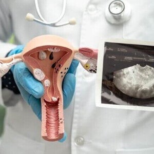 modelo anatômico do útero sendo exibido por um médico com luvas e ultrassonografia ao fundo. modelo anatômico do útero sendo exibido por um médico com luvas e ultrassonografia ao fundo.