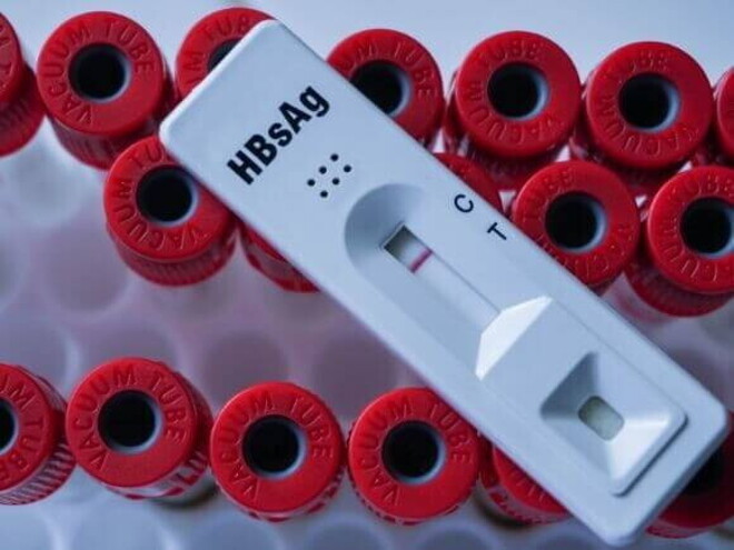 teste rápido de HBsAg em destaque entre tubos de coleta de sangue no laboratório. teste rápido de HBsAg em destaque entre tubos de coleta de sangue no laboratório.