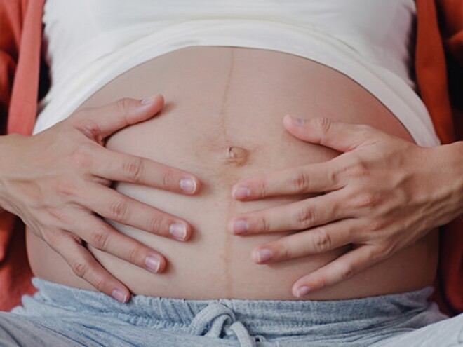 Imagem da barriga de uma gestante com a linha nigra bem evidente