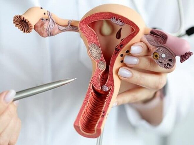 Imagem de um médico segurando um modelo realista do sistema reprodutor feminino Imagem de um médico segurando um modelo realista do sistema reprodutor feminino