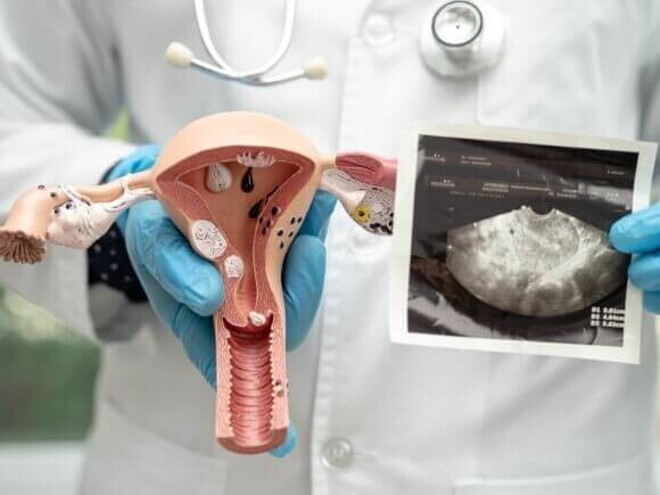 modelo anatômico do útero sendo exibido por um médico com luvas e ultrassonografia ao fundo. modelo anatômico do útero sendo exibido por um médico com luvas e ultrassonografia ao fundo.