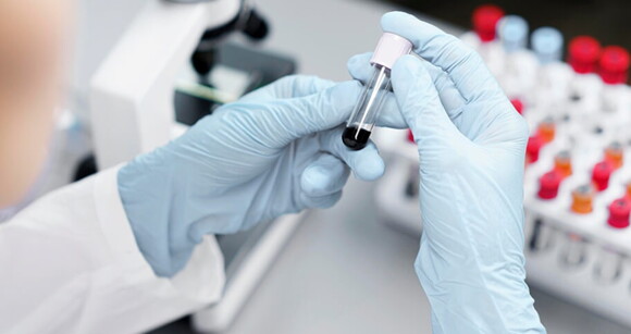 Biomédico segurando um tubo de ensaio, conduzindo um exame em laboratório Biomédico segurando um tubo de ensaio, conduzindo um exame em laboratório