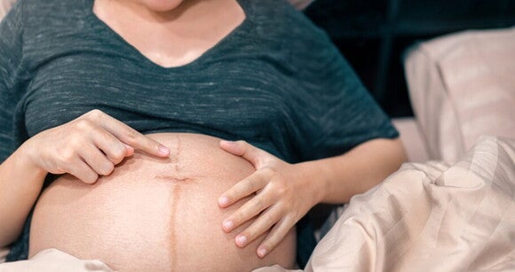 Gestante apontando com a linha nigra em sua barriga
