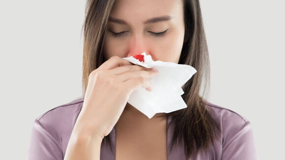 Mulher segurando um papel higiênico no nariz, com uma pequena mancha de sangue Mulher segurando um papel higiênico no nariz, com uma pequena mancha de sangue